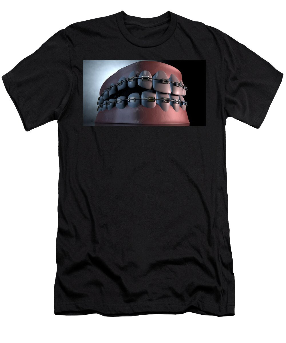 1 Creepy Teeth with Braces Allan Swart T-Shirt