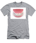 1 Fake Teeth Set with Braces Allan Swart T-Shirt