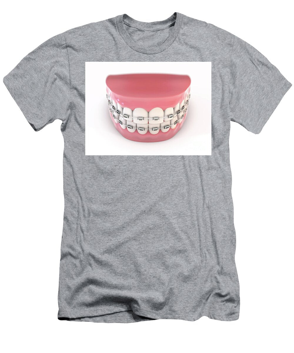 1 Fake Teeth Set with Braces Allan Swart T-Shirt
