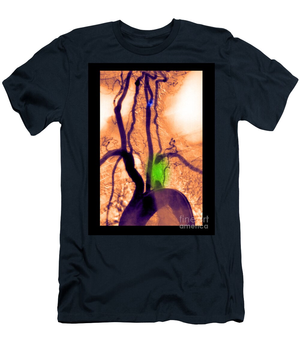2 Aortic Arch Angiogram Medical Body Scans T-Shirt