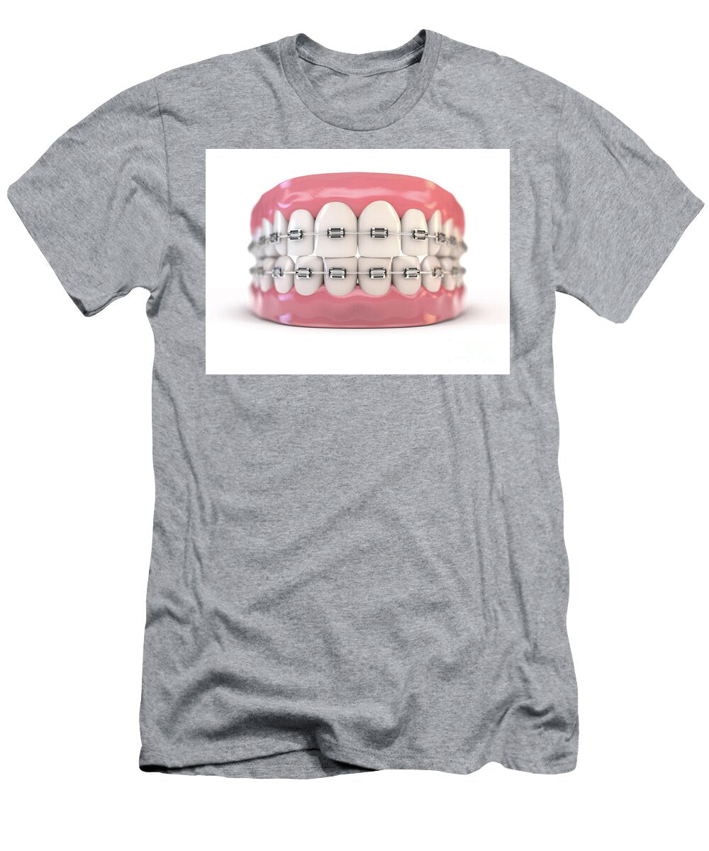 2 Fake Teeth Set with Braces Allan Swart T-Shirt