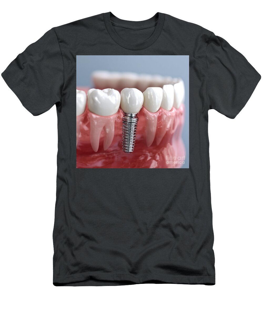 Dental Implant 03 Elisabeth Lucas T-Shirt