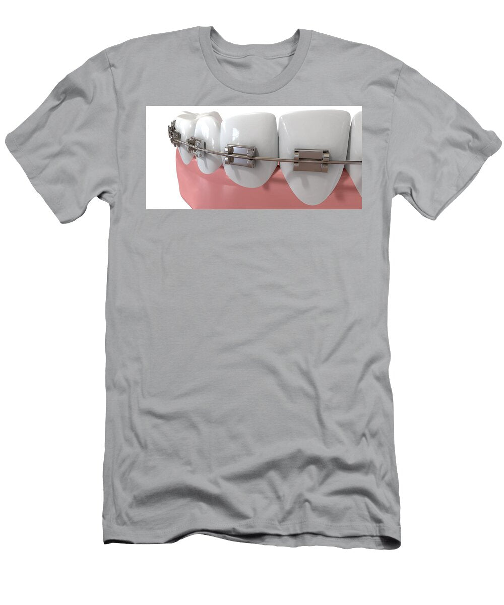 Human Teeth Extreme Closeup with Metal Braces Allan Swart T-Shirt