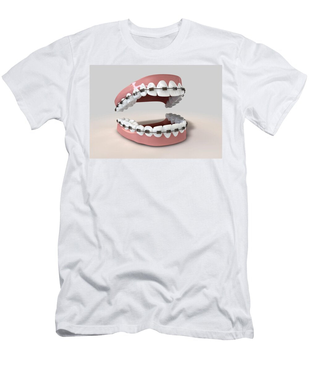 Teeth Fitted with Braces Allan Swart T-Shirt